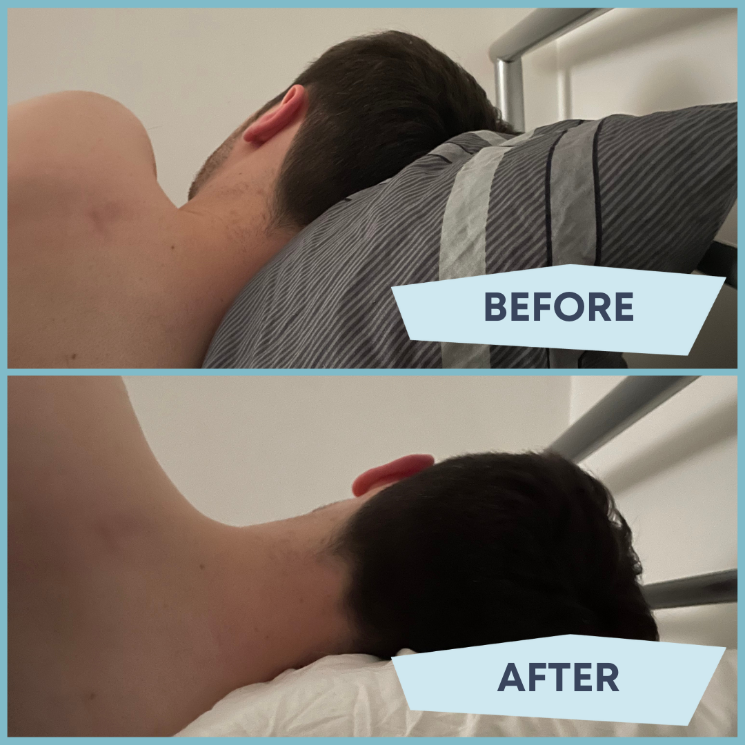 before and after of man laying on pillow